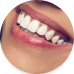 Tratamento com facetas odontológicas